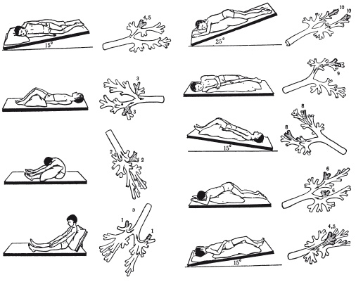 Иллюстрация к книге — Массаж и лечебная физкультура [i_094.jpg]