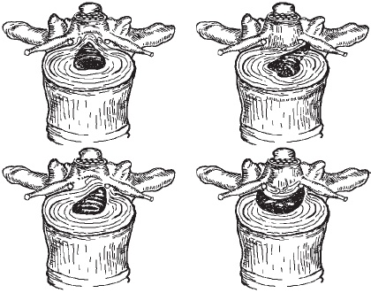 Иллюстрация к книге — Первая скрипка позвоночника. Революционная методика лечения остеохондроза [_25.jpg]