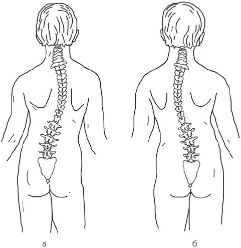Иллюстрация к книге — Первая скрипка позвоночника. Революционная методика лечения остеохондроза [_54.jpg]