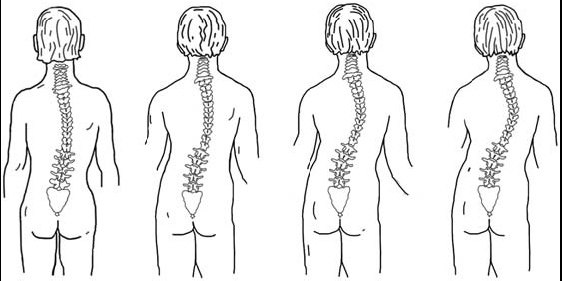 Иллюстрация к книге — Первая скрипка позвоночника. Революционная методика лечения остеохондроза [_56.jpg]
