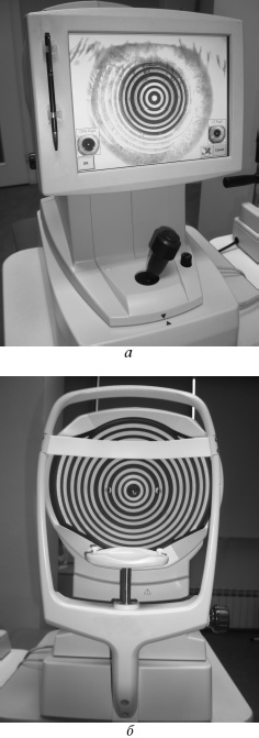 Иллюстрация к книге — Лазерная коррекция зрения [i_018.jpg]