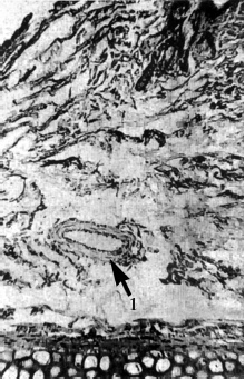 Иллюстрация к книге — Атлас профессионального массажа [i_208.jpg]