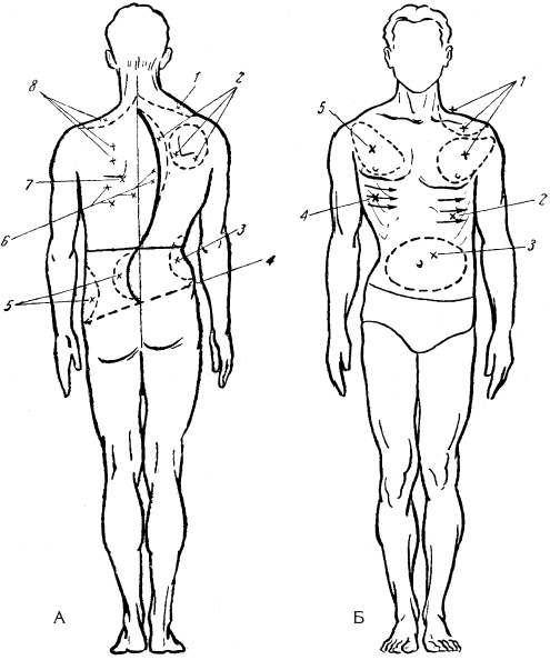 Иллюстрация к книге — Атлас профессионального массажа [i_310.jpg]