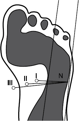 Иллюстрация к книге — Плоскостопие. Самые эффективные методы лечения [Autogen_eBook_id0.jpg]