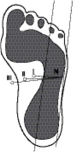 Иллюстрация к книге — Плоскостопие. Самые эффективные методы лечения [Autogen_eBook_id12.jpg]