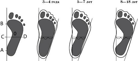 Иллюстрация к книге — Плоскостопие. Самые эффективные методы лечения [Autogen_eBook_id13.jpg]