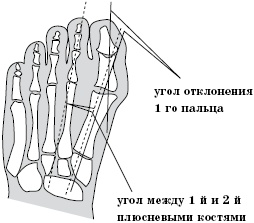 Иллюстрация к книге — Плоскостопие. Самые эффективные методы лечения [Autogen_eBook_id18.jpg]