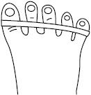 Иллюстрация к книге — Плоскостопие. Самые эффективные методы лечения [Autogen_eBook_id25.jpg]