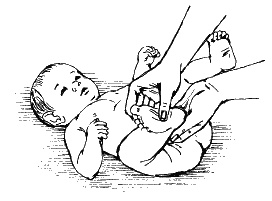 Иллюстрация к книге — Детский массаж. Поэтапное руководство [i_010.jpg]