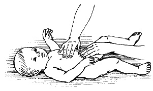 Иллюстрация к книге — Детский массаж. Поэтапное руководство [i_073.jpg]