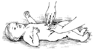 Иллюстрация к книге — Детский массаж. Поэтапное руководство [i_075.jpg]