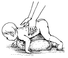 Иллюстрация к книге — Детский массаж. Поэтапное руководство [i_076.jpg]