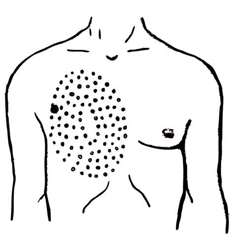 Иллюстрация к книге — Энциклопедия массажа [i_068.jpg]