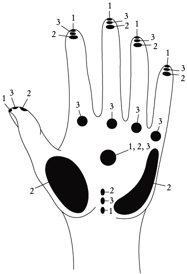 Иллюстрация к книге — Экстренная помощь при травмах, болевых шоках и воспалениях. Опыт работы в чрезвычайных ситуациях [_108.jpg]
