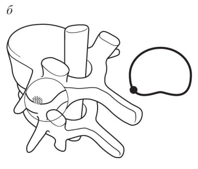 Иллюстрация к книге — Остеохондроз [Autogen_eBook_id25.jpg]