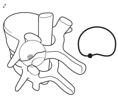 Иллюстрация к книге — Остеохондроз [Autogen_eBook_id27.jpg]