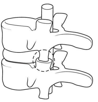 Иллюстрация к книге — Остеохондроз [Autogen_eBook_id3.jpg]