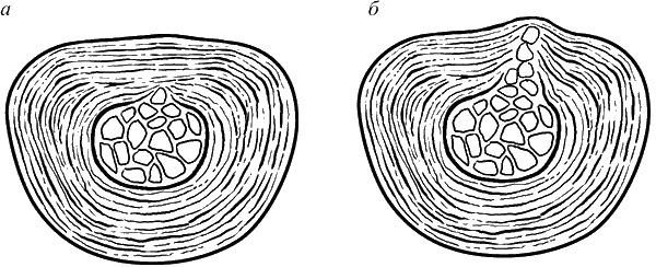 Иллюстрация к книге — Здоровье вашего позвоночника [i_004.jpg]
