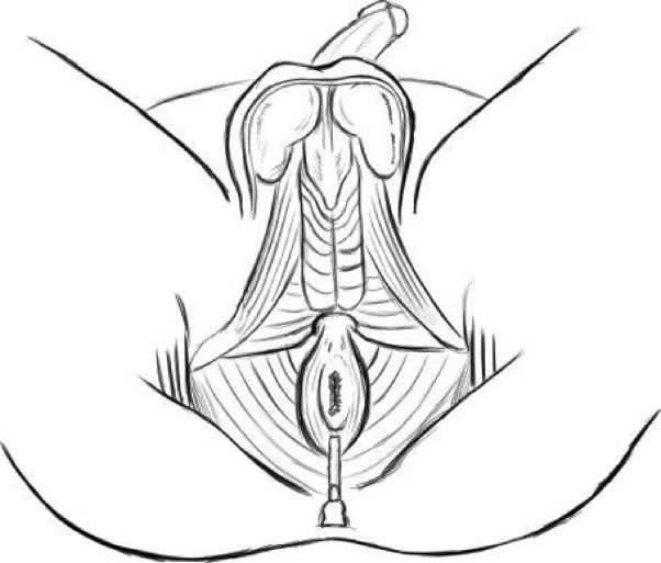 Иллюстрация к книге — Упражнения для увеличения пениса [i_031.jpg]