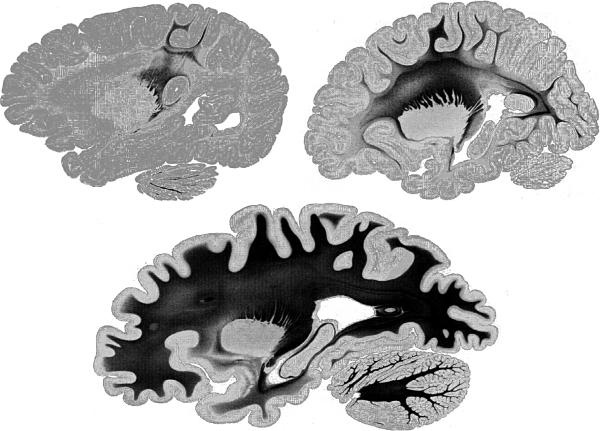 Иллюстрация к книге — Антимозг. Цифровые технологии и мозг [i_049.jpg]