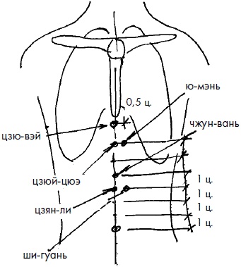 Иллюстрация к книге — 700 китайских упражнений для лечения и предотвращения 100 болезней [Autogen_eBook_id164.jpg]
