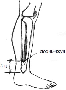 Иллюстрация к книге — 700 китайских упражнений для лечения и предотвращения 100 болезней [Autogen_eBook_id166.jpg]