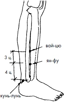 Иллюстрация к книге — 700 китайских упражнений для лечения и предотвращения 100 болезней [Autogen_eBook_id227.jpg]