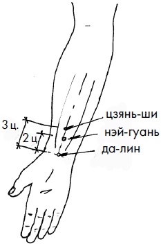 Иллюстрация к книге — 700 китайских упражнений для лечения и предотвращения 100 болезней [Autogen_eBook_id45.jpg]