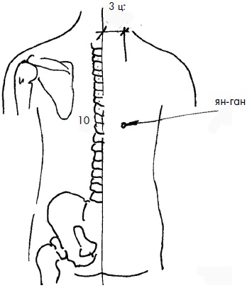 Иллюстрация к книге — 700 китайских упражнений для лечения и предотвращения 100 болезней [Autogen_eBook_id72.jpg]
