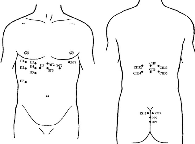 Иллюстрация к книге — Лечение пиявками. Теория и практика гирудотерапии [i_031.jpg]