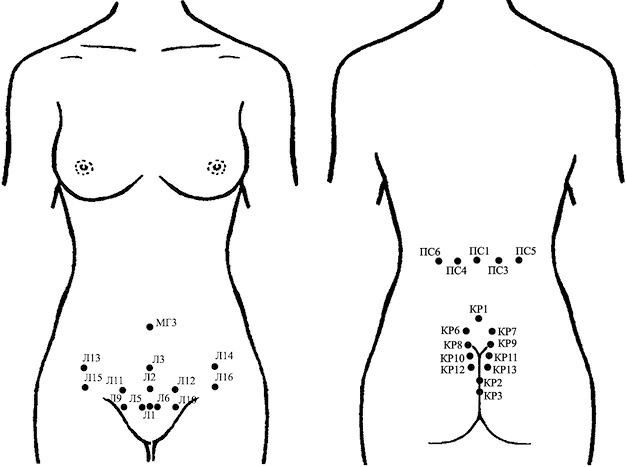Иллюстрация к книге — Лечение пиявками. Теория и практика гирудотерапии [i_044.jpg]