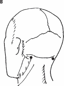Иллюстрация к книге — Избавиться от боли за 30 секунд! Секретные точки здоровья. Тайны древнего Китая [_54.jpg]
