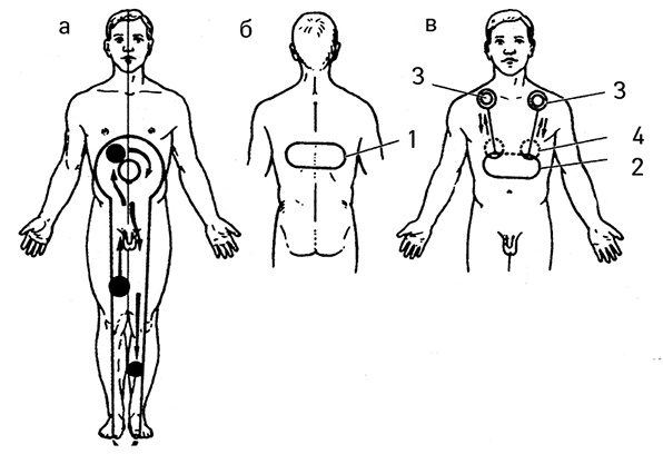 Иллюстрация к книге — Жизнь без таблеток [i_046.jpg]