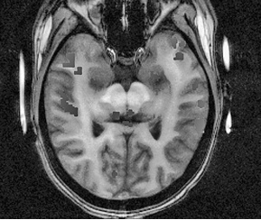 Иллюстрация к книге — Флипноз. Искусство мгновенного убеждения [i_004.jpg]