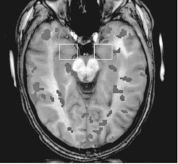 Иллюстрация к книге — Флипноз. Искусство мгновенного убеждения [i_006.jpg]