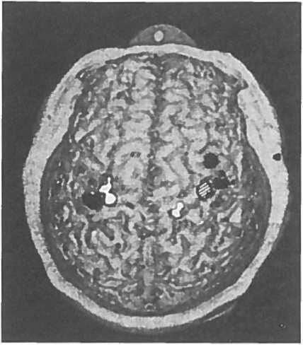 Иллюстрация к книге — Мозг рассказывает. Что делает нас людьми [i_006.jpg]