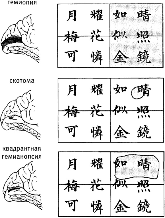Иллюстрация к книге — Мозг и душа. Как нервная деятельность формирует наш внутренний мир [i_011.jpg]
