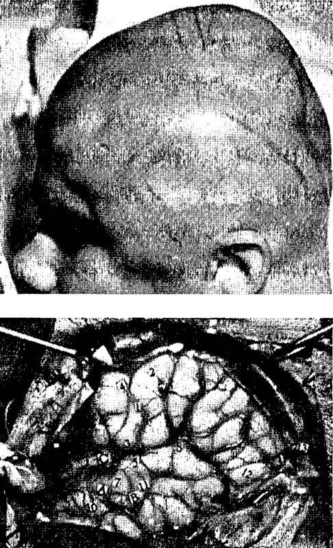 Иллюстрация к книге — Мозг и душа. Как нервная деятельность формирует наш внутренний мир [i_015.jpg]
