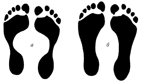 Иллюстрация к книге — Плоскостопие. Легкая походка - здоровый позвоночник [Autogen_eBook_id0.jpg]