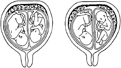 Иллюстрация к книге — Как легко родить, или Путеводитель по родам [_10.jpg]