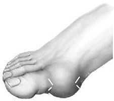 Иллюстрация к книге — Здоровые стопы [i_026.jpg]