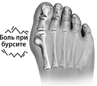 Иллюстрация к книге — Здоровые стопы [i_031.jpg]