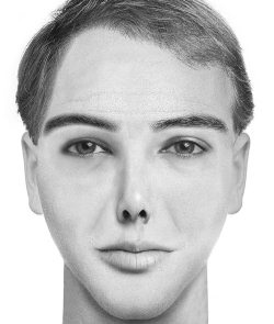 Иллюстрация к книге — Комплексная визуальная диагностика [i_087.jpg]