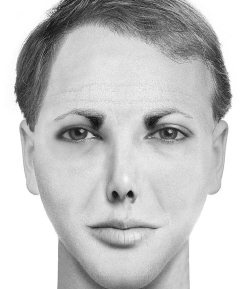 Иллюстрация к книге — Комплексная визуальная диагностика [i_102.jpg]