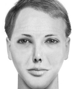 Иллюстрация к книге — Комплексная визуальная диагностика [i_108.jpg]