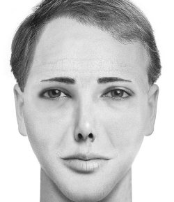 Иллюстрация к книге — Комплексная визуальная диагностика [i_109.jpg]