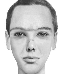 Иллюстрация к книге — Комплексная визуальная диагностика [i_205.jpg]