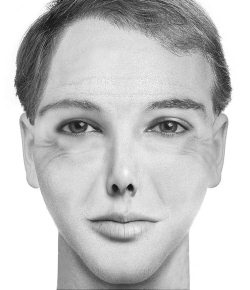 Иллюстрация к книге — Комплексная визуальная диагностика [i_208.jpg]