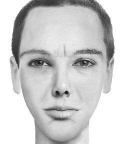 Иллюстрация к книге — Комплексная визуальная диагностика [i_225.jpg]