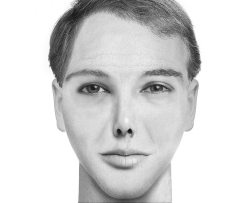 Иллюстрация к книге — Комплексная визуальная диагностика [i_251.jpg]